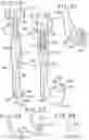 Fig. 11 - Apparatus and methods for disrupting inter vertebral disc tissue