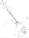 Fig. 02 - SYSTEMS AND METHODS FOR REMOVING MATERIALS FROM THE PANCREAS USING AN ENDOSCOPIC SURGICAL TOOL