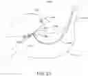 Fig. 22 - SYSTEMS AND METHODS FOR REMOVING MATERIALS FROM THE PANCREAS USING AN ENDOSCOPIC SURGICAL TOOL