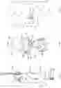 Fig. 03 - Endoscopic resection assembly