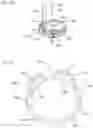 Fig. 05 - Endoscopic resection assembly