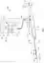 Fig. 02 - Atherectomy devices and methods