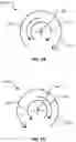 Fig. 10 - Atherectomy devices and methods