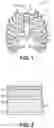 Fig. 02 - BONE-PENETRATING MANUAL DRIVER AND STABILIZER ASSEMBLY FOR INTRAOSSEOUS ACCESS