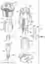 Fig. 04 - BONE-PENETRATING MANUAL DRIVER AND STABILIZER ASSEMBLY FOR INTRAOSSEOUS ACCESS