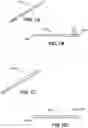Fig. 07 - BONE-PENETRATING MANUAL DRIVER AND STABILIZER ASSEMBLY FOR INTRAOSSEOUS ACCESS