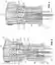 Fig. 08 - BONE-PENETRATING MANUAL DRIVER AND STABILIZER ASSEMBLY FOR INTRAOSSEOUS ACCESS