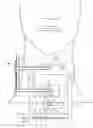 Fig. 01 - Retractor, distractor, and camera system for cervical procedures