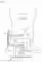 Fig. 02 - Retractor, distractor, and camera system for cervical procedures