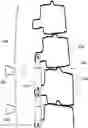 Fig. 01 - Non-invasively adjustable spinal stabilization device