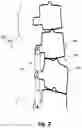 Fig. 03 - Non-invasively adjustable spinal stabilization device