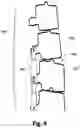 Fig. 05 - Non-invasively adjustable spinal stabilization device