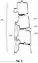Fig. 06 - Non-invasively adjustable spinal stabilization device