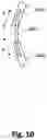 Fig. 11 - Non-invasively adjustable spinal stabilization device