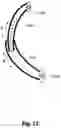 Fig. 12 - Non-invasively adjustable spinal stabilization device