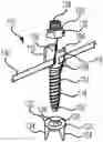 Fig. 01 - SCOLIOSIS CORRECTION SYSTEMS, METHODS, AND INSTRUMENTS