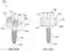 Fig. 12 - SCOLIOSIS CORRECTION SYSTEMS, METHODS, AND INSTRUMENTS