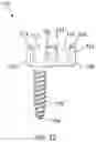 Fig. 13 - SCOLIOSIS CORRECTION SYSTEMS, METHODS, AND INSTRUMENTS