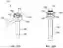 Fig. 17 - SCOLIOSIS CORRECTION SYSTEMS, METHODS, AND INSTRUMENTS