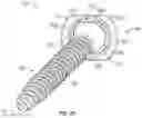 Fig. 05 - Bone anchor