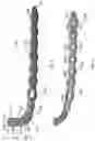 Fig. 03 - DISTAL TIBIAL PLATING SYSTEM