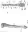 Fig. 08 - DISTAL TIBIAL PLATING SYSTEM
