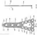 Fig. 19 - DISTAL TIBIAL PLATING SYSTEM