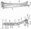 Fig. 20 - DISTAL TIBIAL PLATING SYSTEM