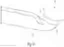 Fig. 06 - ELECTROSURGICAL DEVICE FOR CUTTING AND REMOVING TISSUE