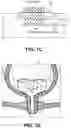 Fig. 10 - SYSTEMS AND METHODS FOR THERAPY OF PELVIC CONDITIONS