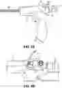 Fig. 18 - SYSTEMS AND METHODS FOR THERAPY OF PELVIC CONDITIONS