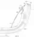 Fig. 05 - SPHINCTEROTOME DEVICE AND METHODS AND USES THEREOF