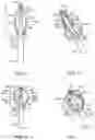Fig. 04 - MULTI-MODAL CATHETER FOR IMPROVED ELECTRICAL MAPPING AND ABLATION
