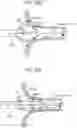 Fig. 22 - MULTI-MODAL CATHETER FOR IMPROVED ELECTRICAL MAPPING AND ABLATION