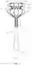 Fig. 02 - ATRIAL SEPTOSTOMY DEVICE
