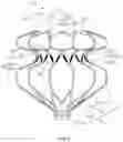 Fig. 04 - ATRIAL SEPTOSTOMY DEVICE