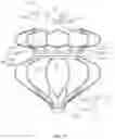 Fig. 12 - ATRIAL SEPTOSTOMY DEVICE