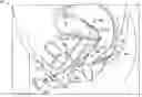 Fig. 01 - Uterine manipulator with neutral return electrode