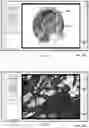 Fig. 07 - Computer-Implemented Method, Computer-Assisted Processing Device and Non-Transitory Computer-Readable Medium for Computer-Assisted Planning of Surgical Path