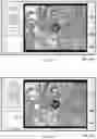 Fig. 08 - Computer-Implemented Method, Computer-Assisted Processing Device and Non-Transitory Computer-Readable Medium for Computer-Assisted Planning of Surgical Path