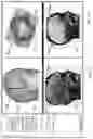 Fig. 12 - Computer-Implemented Method, Computer-Assisted Processing Device and Non-Transitory Computer-Readable Medium for Computer-Assisted Planning of Surgical Path