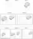 Fig. 06 - Method and assembly for spatial mapping of a model, such as a holographic model, of a surgical tool and/or anatomical structure onto a spatial position of the surgical tool respectively anatomical structure, as well as a surgical tool