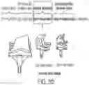 Fig. 15 - METHODS FOR IMPROVING ROBOTIC SURGICAL SYSTEMS AND DEVICES THEREOF