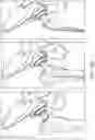 Fig. 34 - METHODS FOR IMPROVING ROBOTIC SURGICAL SYSTEMS AND DEVICES THEREOF