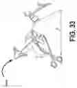 Fig. 61 - METHODS FOR IMPROVING ROBOTIC SURGICAL SYSTEMS AND DEVICES THEREOF