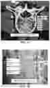 Fig. 05 - Systems and methods for assisting and augmenting surgical procedures