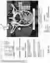Fig. 06 - Systems and methods for assisting and augmenting surgical procedures
