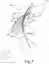 Fig. 08 - Interactive anterior-posterior axis determination