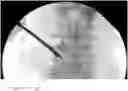 Fig. 01 - APPARATUS AND METHODS FOR USE WITH IMAGE-GUIDED SKELETAL PROCEDURES