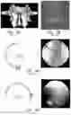 Fig. 05 - APPARATUS AND METHODS FOR USE WITH IMAGE-GUIDED SKELETAL PROCEDURES
